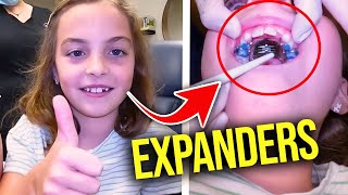 Getting a Palatal ExpanderHow expanders work  McKinney Orthodontist [upl. by Alehtse549]