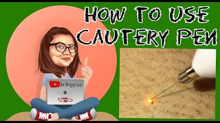 How to use Cautery Pen mole and wart removal pen docmenggay [upl. by Lerual554]