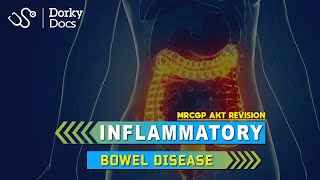 Inflammatory Bowel Disease IBD  The MRCGP AKT Exam Revision I Dorky Docs [upl. by Milas]