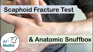 Scaphoid Fracture Test Clinical Exam and the Anatomic Snuffbox [upl. by Airalav911]