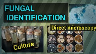 Fungal infectionFungal identificationFungal culture test procedureFungal diseaseSTAR LABORATORY [upl. by Atalya679]