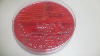 Klebsiella and Staphylococcus growth on CLED agar Uropathogens [upl. by Wyatan897]