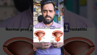 urimax 04 kis kaam aati hai  tamsulosin hcl 04 mg capsule uses shorts medical [upl. by Riki]