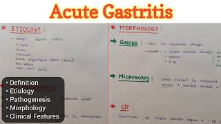 Acute Gastritis  Gastritis 23  GIT Pathology [upl. by Egni]