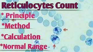 Reticulocyte Count  Staining Principle Method Calculation  Normal Range Interpretation [upl. by Genny]