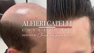 Chuck Alfieri Capelli Hair Replacement Men 032024 [upl. by Dam]