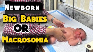 Big Babies or Macrosomia Causes and Complications in UrduHindi [upl. by Kcirddehs]