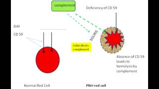 Paroxysmal Nocturnal Hemoglobinuria [upl. by Onitram403]