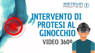 🔴 INTERVENTO PROTESI del GINOCCHIO ▷▷ VIDEO A 360º [upl. by Ayamat]