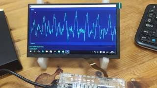 Pulse measuring project on a LattePanda Windows and Arduino [upl. by Meingoldas181]