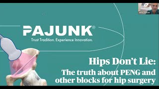 The Hips Don’t Lie The Truth about PENG amp Other Hip Blocks [upl. by Beckett489]