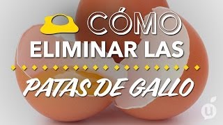 Cómo eliminar las patas de gallo  Cómo quitar las arrugas de los ojos [upl. by Eninahs]