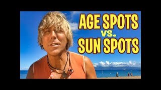 AGE SPOTS or SUN SPOTS on Skin How to Get Rid of Them [upl. by Elboa]