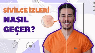 Sivilce İzleri Nasıl Geçer Akne İzleri Tedavisi [upl. by Inaja]