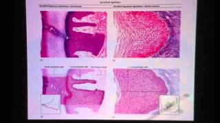 Nonkeratinized Stratified Squamous Epithelium [upl. by Happ]