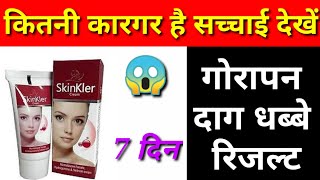 Skinkler cream Skinkler Cream Side Effects in HindiSkinkler Cream Review in HindiSkinkler Uses [upl. by Adahsar]