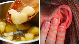 How to Make Garlic Oil Ear Drops for Ear Infections amp Ear Aches [upl. by Aicitel769]