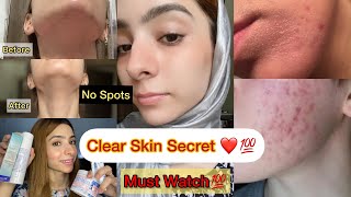 I Tried A 10Step Korean Skincare Routine For A Month [upl. by Vescuso]