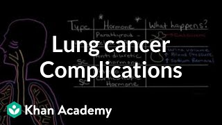 Lung cancer complications  Respiratory system diseases  NCLEXRN  Khan Academy [upl. by Omlesna]