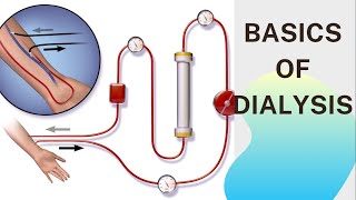 Basic concept of Dialysis Machine  Fresenius 4008S  Dialyzer amp Dialysate Function [upl. by Mendoza]