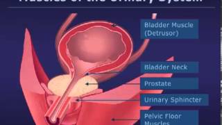 Botox Injections for Bladder Conditions [upl. by Barbara301]