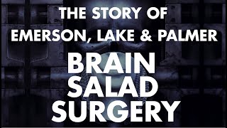 Emerson Lake amp Palmer  Story of Brain Salad Surgery Documentary [upl. by Furr796]