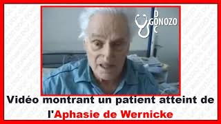 Aphasia Wernickes vs Brocas  Clinical Anatomy  Kenhub [upl. by Oremodlab574]