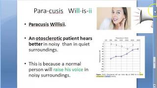 ENT Paracusis Willisii Ear Otospongiosis Otosclerosis Hear better loud speak outside home [upl. by Silecara806]