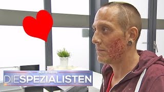 Herzförmige Verbrennung im Gesicht wie ist das passiert  Die Spezialisten  SAT1 TV [upl. by Heins444]