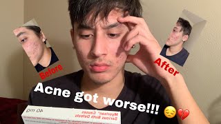 ACCUTANE JOURNEY  1 Month update Acne got worse [upl. by Dalton116]