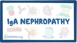 Membranous Nephropathy Types Causes and Mnemonics  Nephrotic Syndrome  Glomerulonephritis [upl. by Femmine]