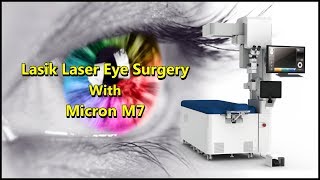 Lasik Laser Eye Surgery With Micron M7 [upl. by Mortie]