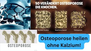 Osteoporose ist KEIN Kalziumproblem [upl. by Hildick]