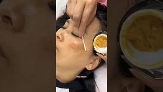 Remove Dark Spots amp Pigmentation Naturally At Home  Get Glowing Skin skin beautiful shorts [upl. by Debi137]