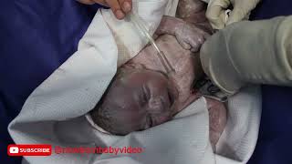 Special newborn baby with high weight the moment after delivery viral baby cute [upl. by Seaden]