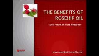 The Benefits of Rosehip Oil [upl. by Adroj]