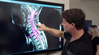 Symptoms of Cervical Stenosis  Jeffrey Cantor MD [upl. by Gayleen]