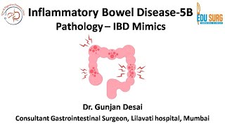 IBD mimics  Crohns disease and Ulcerative colitis mimics on biopsy  Inflammatory bowel disease 5B [upl. by Dylana]