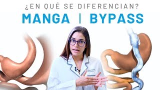 Diferencias entre Bypass Gástrico y Manga Gástrica  Clínicas Diego de León [upl. by Niaz979]