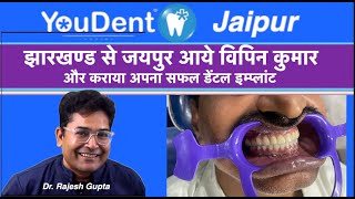 Vipin Kumar का हुआ सफल Dental Implant जानिए कैसे   By Dr Rajesh Gupta [upl. by Siana]