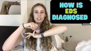 Hypermobile EDS Diagnostic Criteria 2017 [upl. by Yrrem]