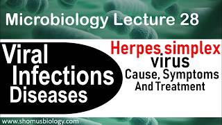 Herpes simplex virus microbiology  Cause symptoms and treatments [upl. by Aenert373]