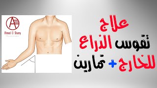 تقوس الذراع للخارج  تمارين علاج تقوس الكوع للخارج  Cubitus valgus [upl. by Des682]