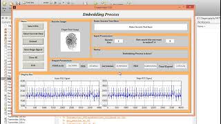 MATLAB code of Curvelet Based ECG Steganography for Privacy Protection [upl. by Dnomaj643]