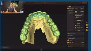 Primeprint Occlusal Splint Workflow [upl. by Atteoj]