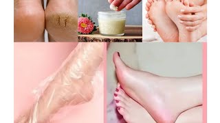 Get Beautiful Soft Feet amp Cracked Heels Removal Super Home Remedy with Noor Ali [upl. by Eerrehc]