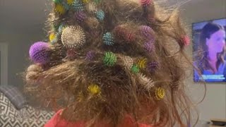 6YearOld Gets 150 Bunchems Velcro Balls Stuck in Her Hair [upl. by Oecile]