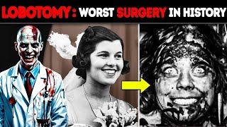 Why is LOBOTOMY The WORST Surgery in History [upl. by Menon]