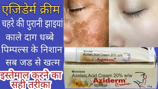 AZIDERM CREAM REVIEW चहरे के काले दाग धब्बे झाइयांएकने पिम्पल्स सब जड से खत्म करने की क्रीम [upl. by Atterehs]