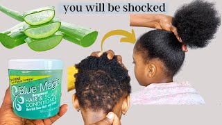 DIY Thick Hair Growth Serum  घर पर हल्के बालों को करें घना 100👍🏻 उगाएँ Hairline Bald Patches [upl. by Merchant]